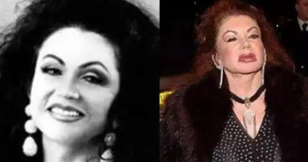 年轻的时候整容老了脸会崩吗,整过形的脸老了好不好