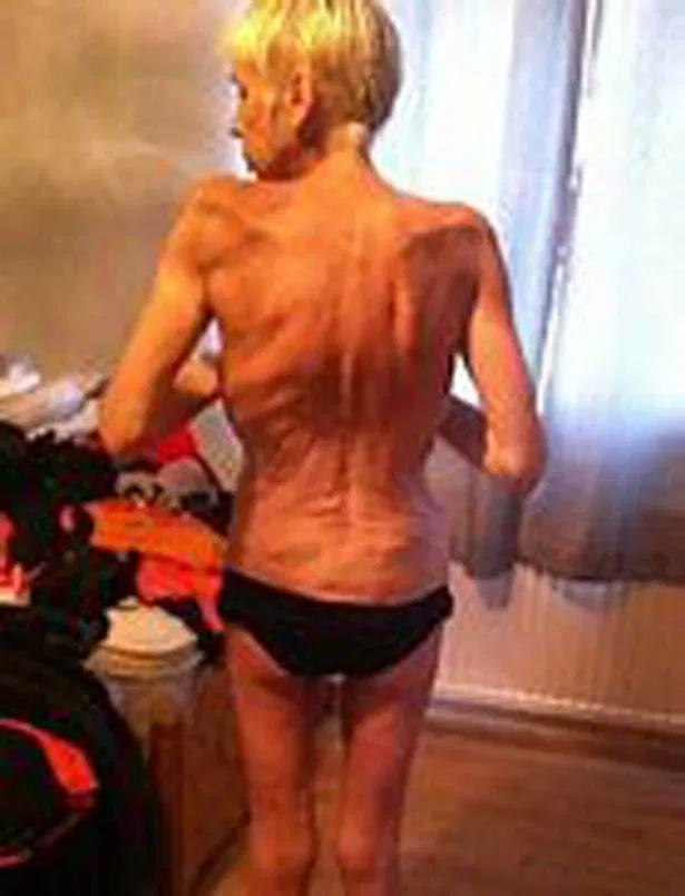 朋友圈卖的减肥产品是真的吗,网红卖的减肥药都是真的吗