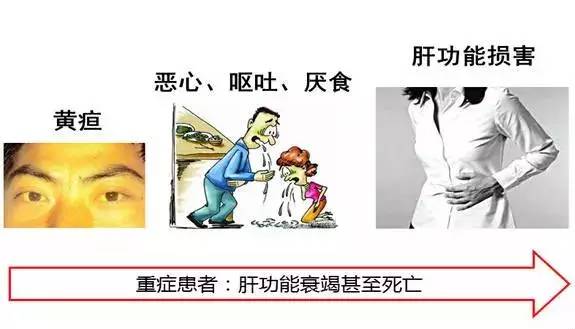 散伙饭“吃垮”毕业生!几个蒜蓉扇贝,竟然吃进了重症监护