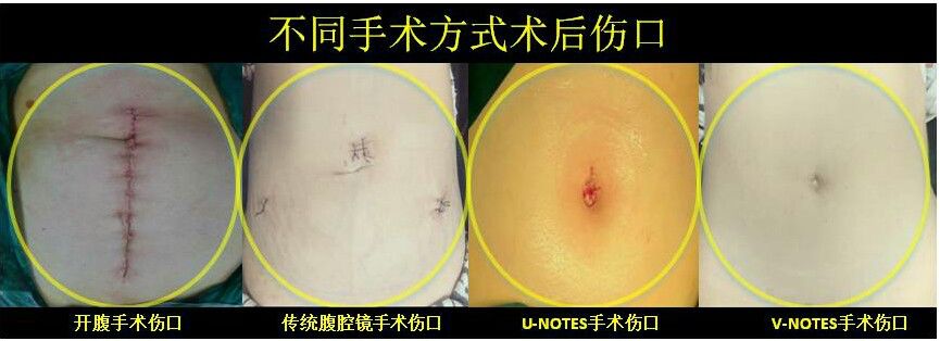 妇产科新技术怎么做,妇产科诊疗新技术