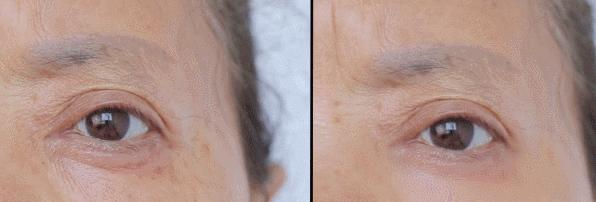 又好用又不贵的30岁以上的眼霜,25岁以上适合的平价眼霜