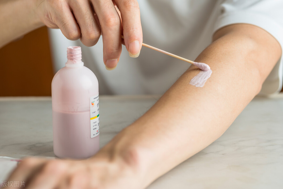 皮肤瘙痒怎么办？这4个外用止痒药膏建议家中常备