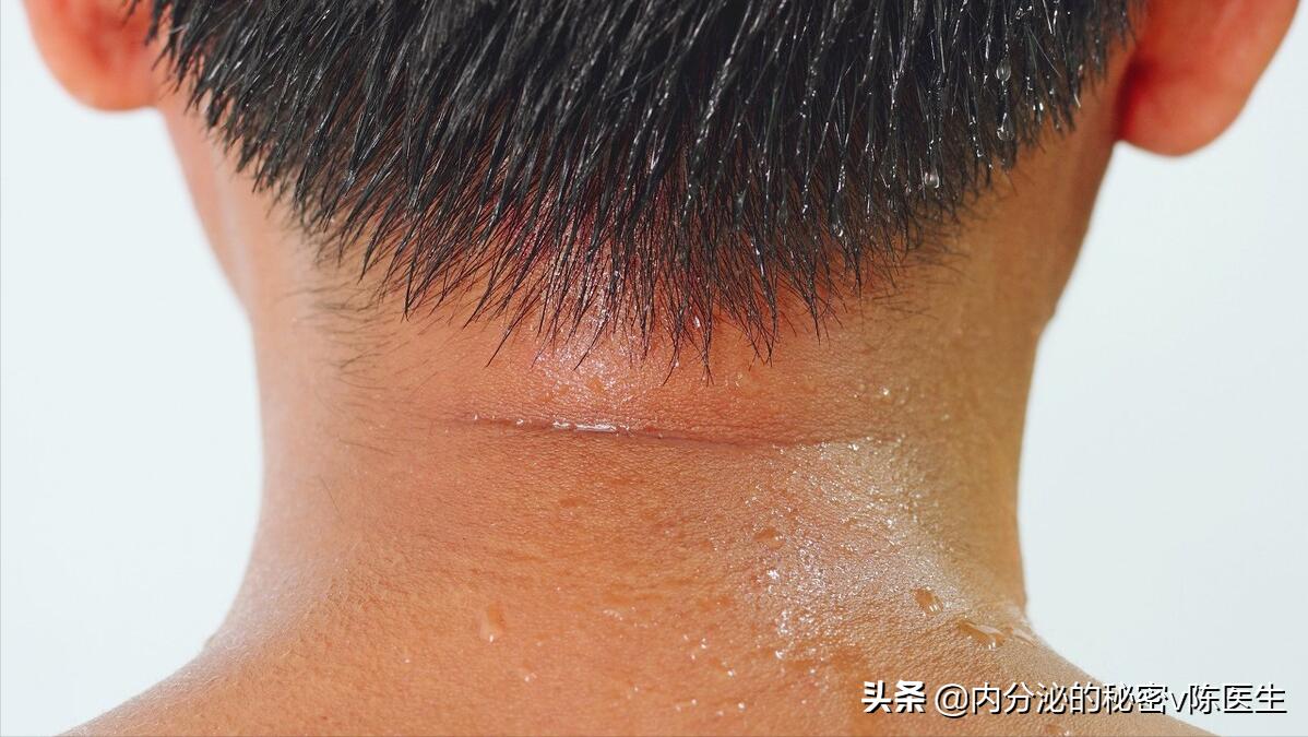 糖尿病出汗异常怎么办,中医糖尿病乏力出汗治疗