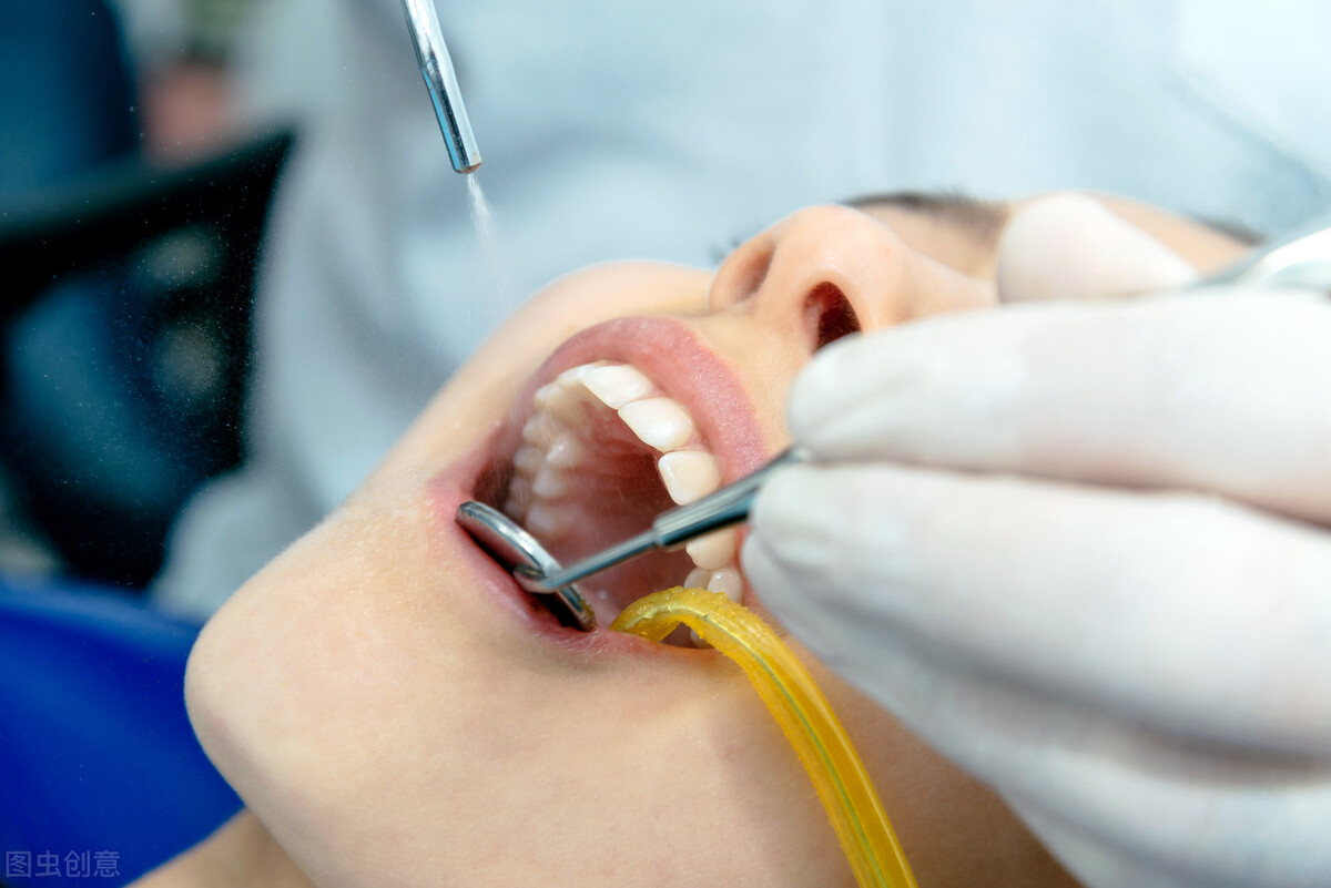 白牙正确打开方式,大白牙的正确养成方法