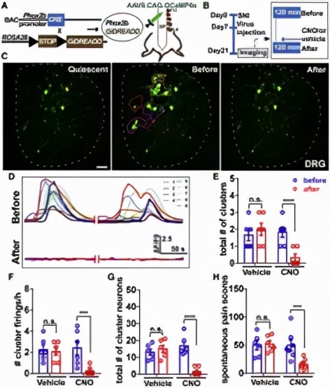 Neuron：董欣中/张俊明合作揭示神经损伤后自发性疼痛产生新机制