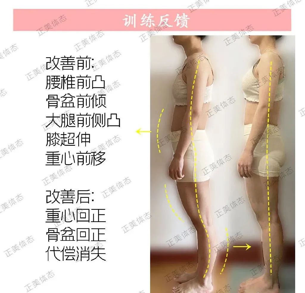 腿不直怎么修饰腿型,塑造腿型