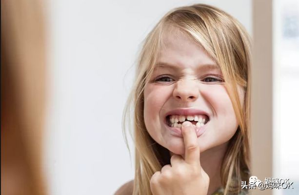 预防乳牙不齐的方法,牙不齐需要乳牙期干预么