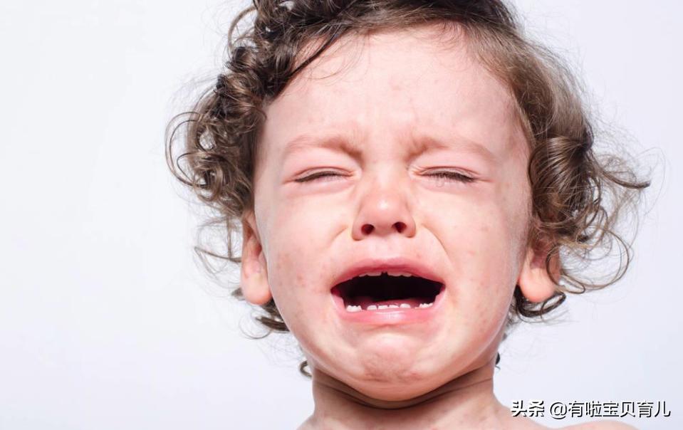 婴幼儿可用的过敏止痒的药膏,婴儿止痒特效药