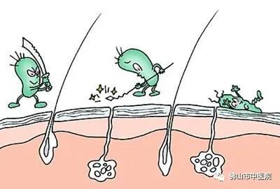 中医特效药中成药大全,中医教你做特效药