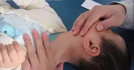 颈部胸锁乳突肌后部有结节,颈部胸锁乳突肌有一个包