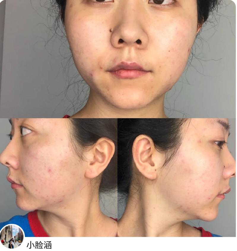 养肤型粉底液百元,适合干油皮的粉底液低价