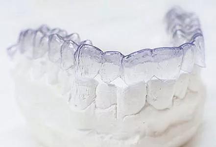 戴牙套前必须知道的事,戴牙套全过程及后期问题