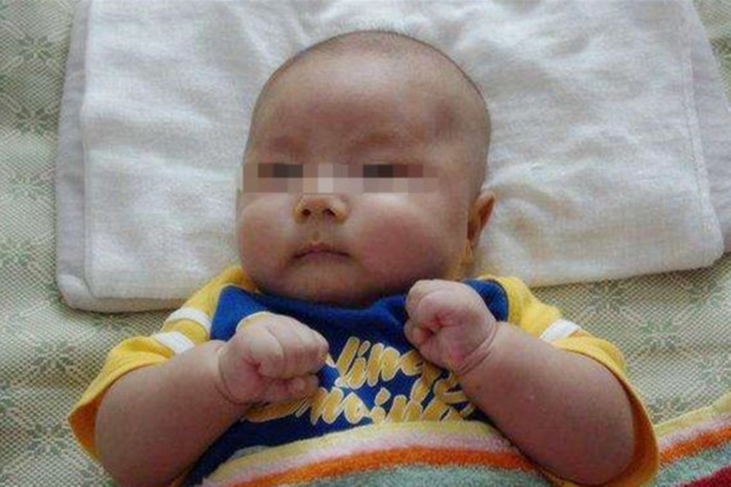 宝宝得了脑瘫怎么办,孩子出现脑瘫的前兆