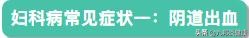 妇一科疾病自检大全,妇科疾病自检100例