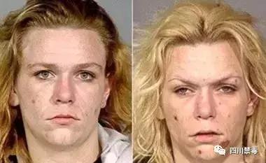 真实的吸毒者有多恐怖,吸毒后的恐怖事件