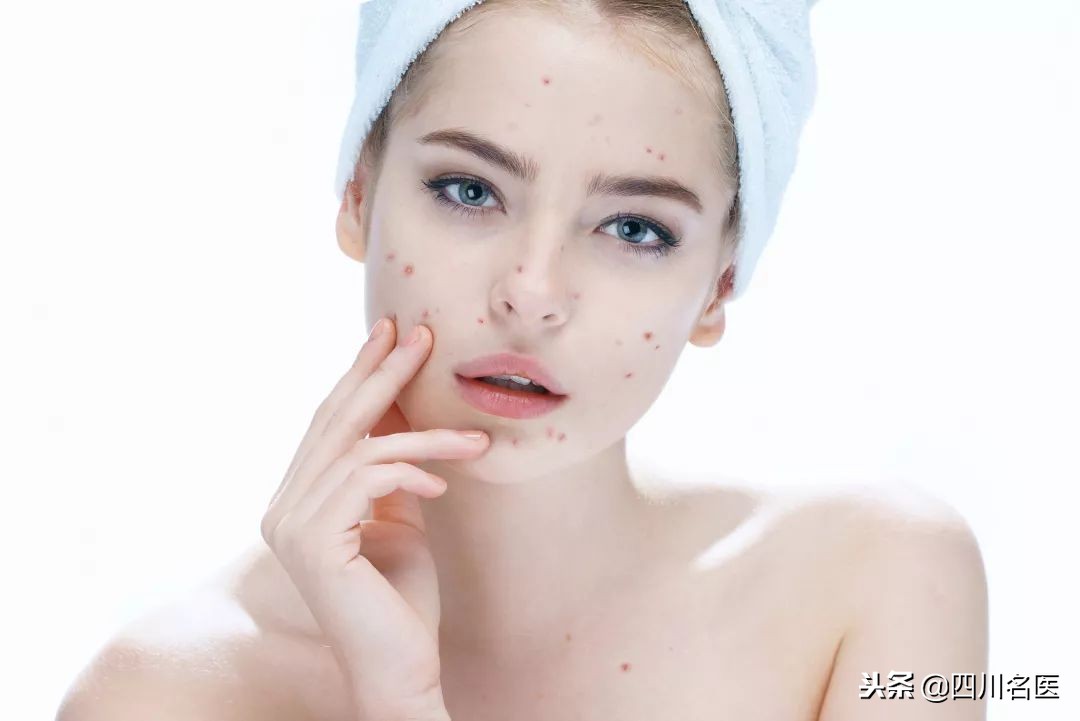 华佗国药祛斑丸是真的吗,华佗祛斑美白产品