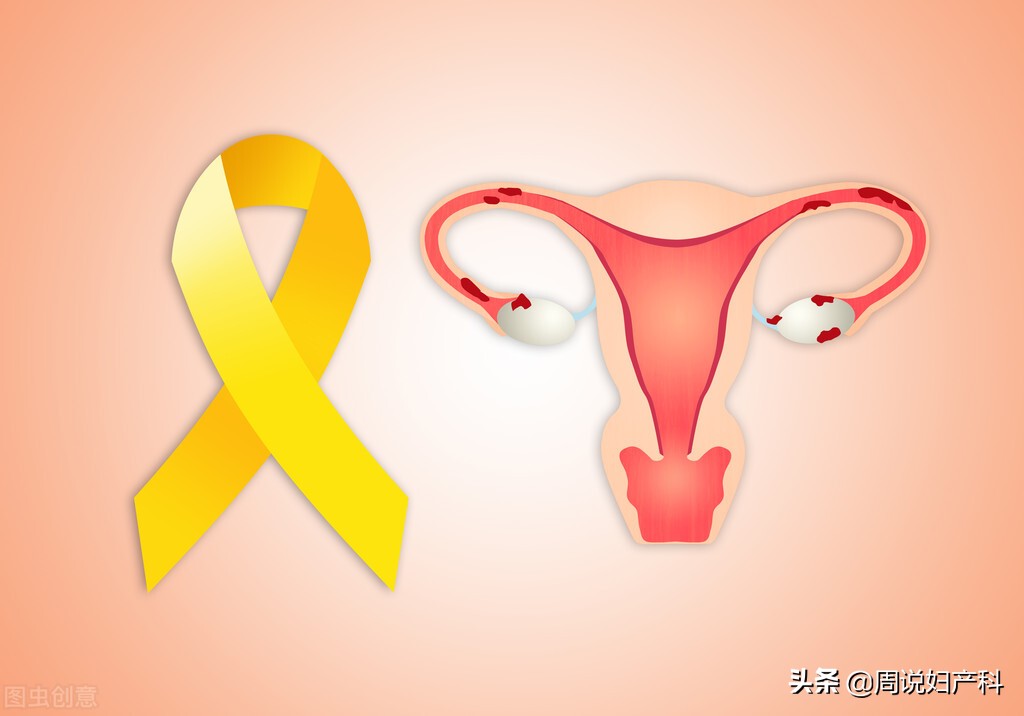 想知道子宫有没有癌症要检查什么,妇科检查会查出来子宫有问题吗