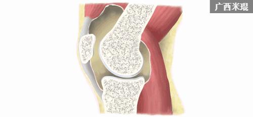骨科大夫米琨为您详解:关节痛了怎么办?