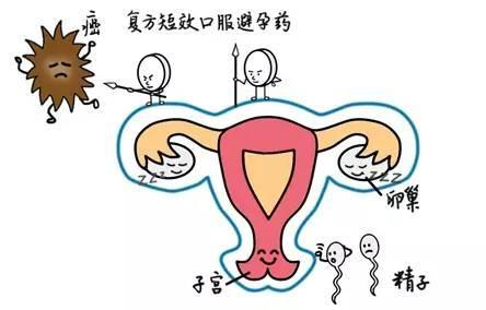 避孕药可以治黄体功能不全吗,避孕药真能治多囊吗