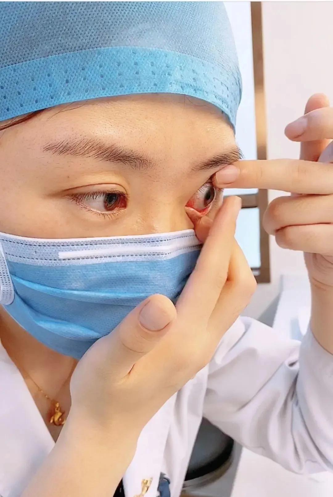 隐形眼镜怎么摘才不会伤害视网膜,隐形眼镜怎么摘都摘不下来怎么办