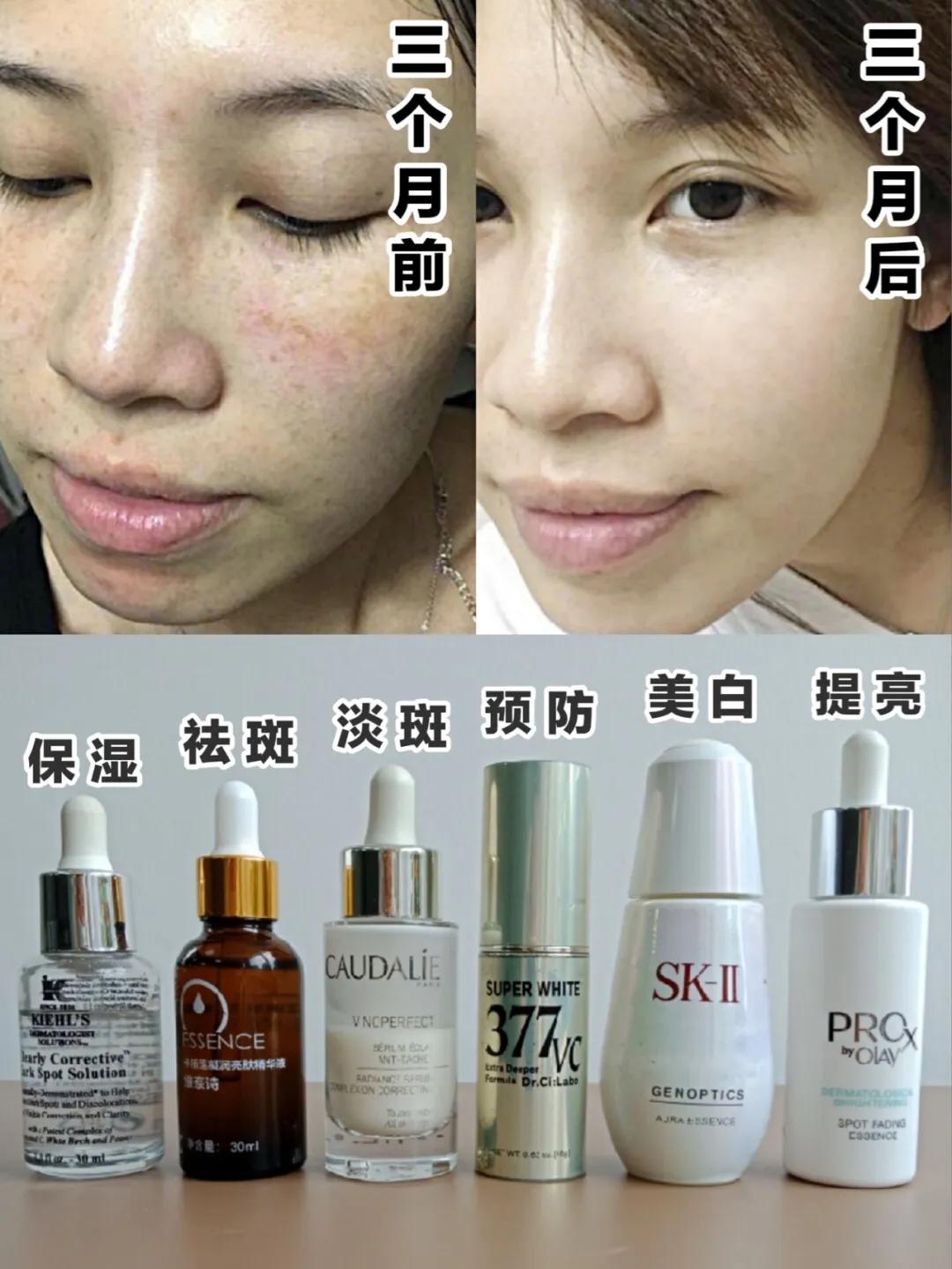 2022祛斑精华排行榜前十名,6款网红热门祛斑精华大测评
