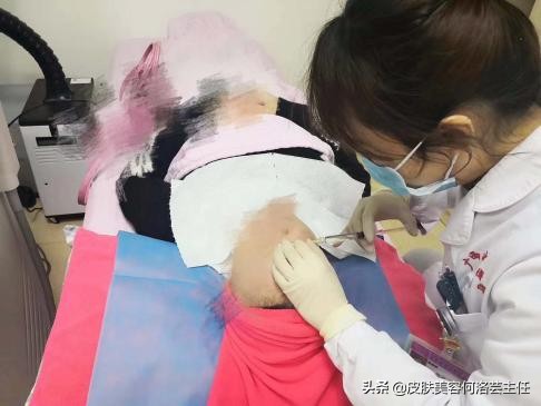 水光针的十问十答,长效水光针和短效水光针怎么样