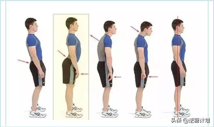 50岁女性如何补钙对抗骨质疏松,骨质疏松什么程度才可以打补钙针