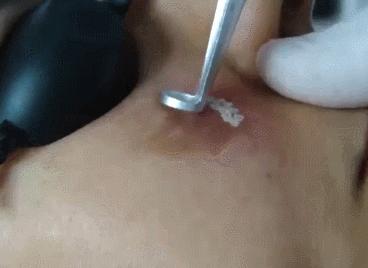 怎么改善肤色黄暗沉,怎么才能改善暗黄淡斑