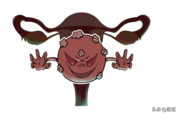 hpv感染与宫颈癌宣传科普,关爱女性健康之宫颈癌