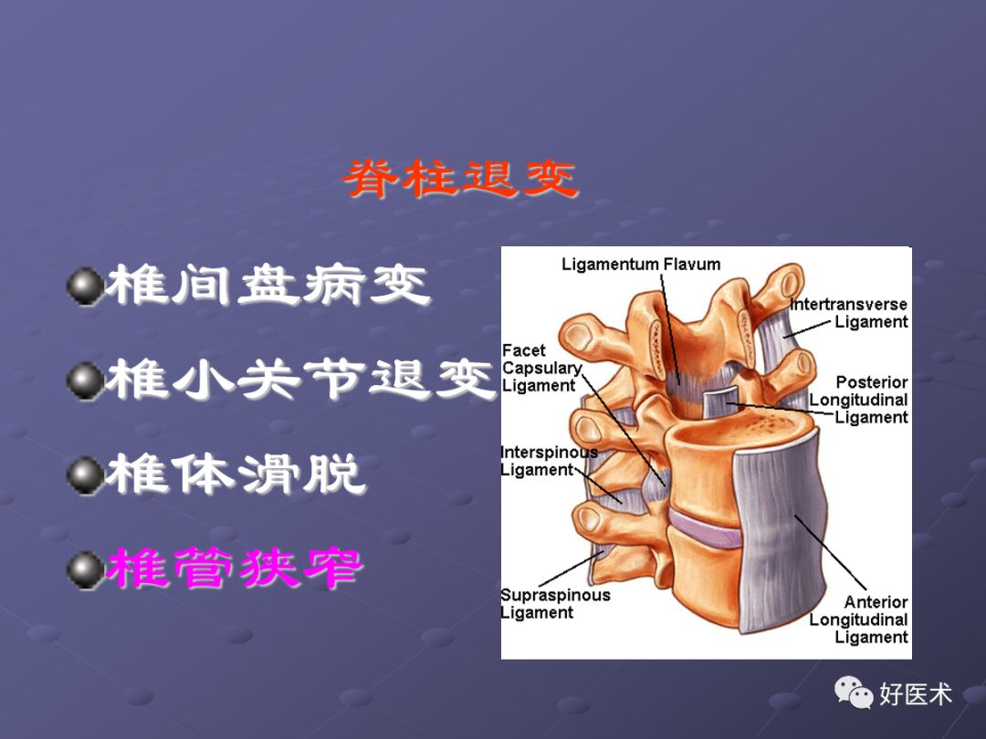 脊柱mri有哪些特点,乳腺疾病的mri诊断及鉴别