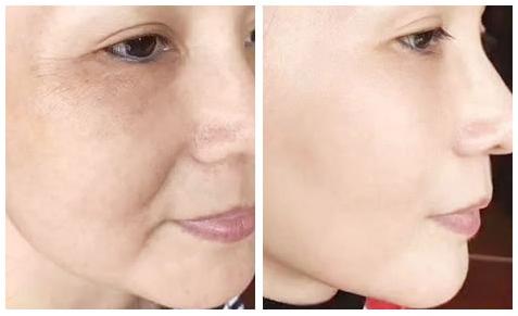 虾青素真的可以抗氧化吗,虾青素抗氧成功