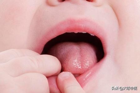 宝宝舌头能反映什么病,看孩子的舌头知道身体状况