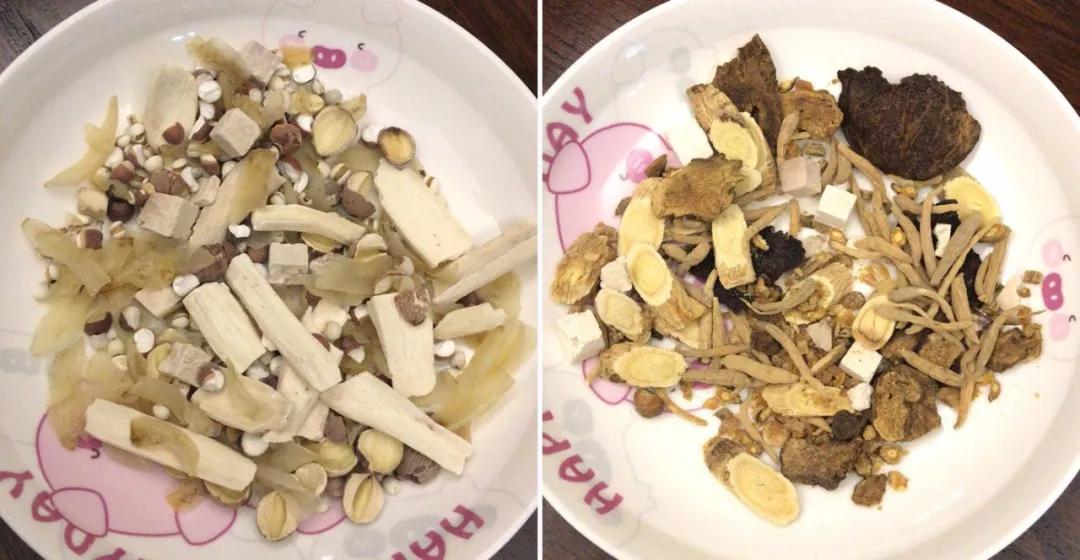 坚持锻炼可以缓解过敏性鼻炎吗,坚持锻炼可以治疗鼻炎吗