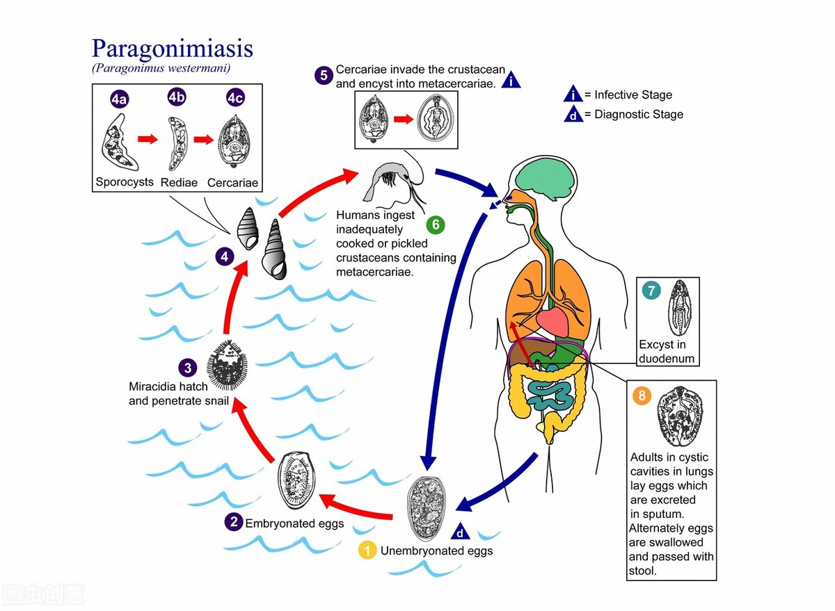 小孩喝了溪水的脏水发烧,头痛欲裂有可能是寄生虫吗