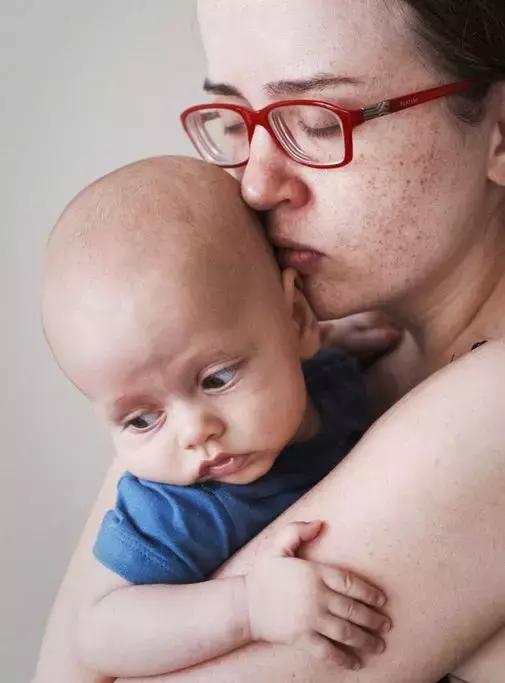 婴儿皮肤青紫多久能消,新生宝宝皮肤红块