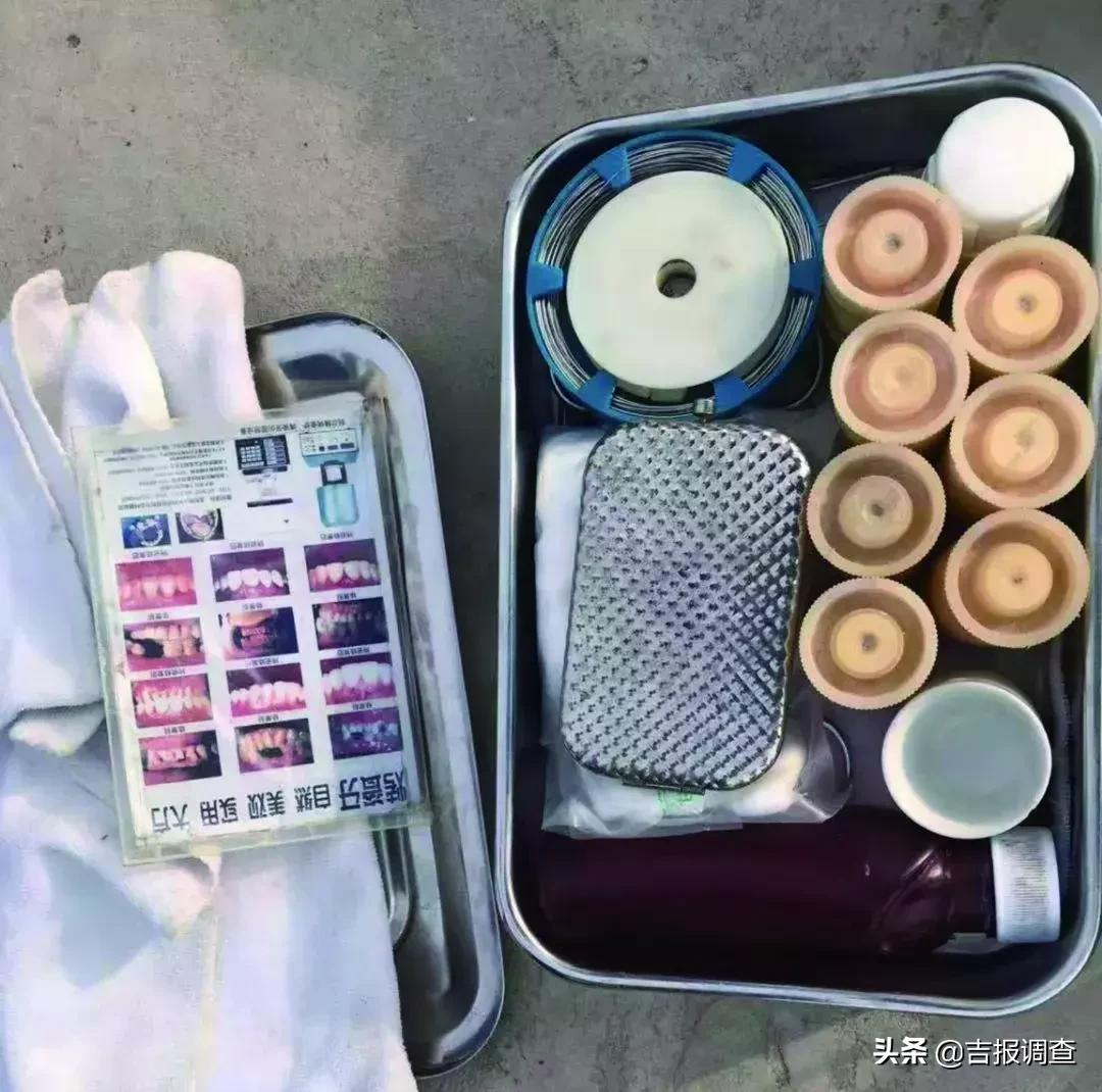 通榆抓了俩*子骗**，镶牙用石膏和胶粘，一碰就掉，镶完就跑……