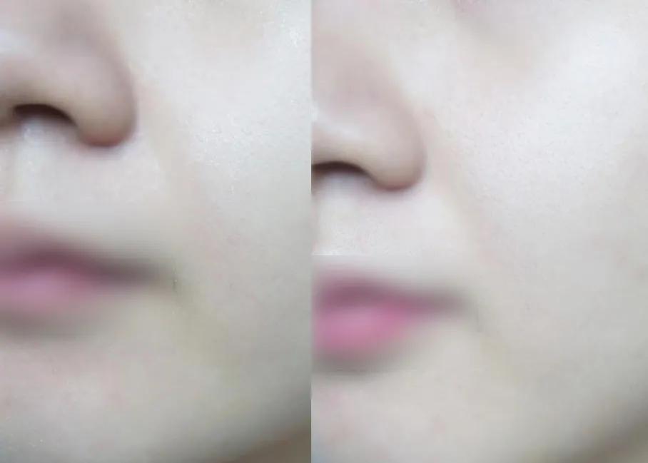 每天十分钟消除法令纹，填充鼻基底「内附矫正视频」