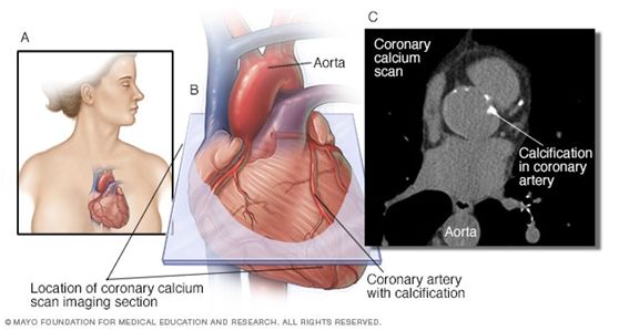 有关心脏病的纪录片,关于心脏病的纪录片