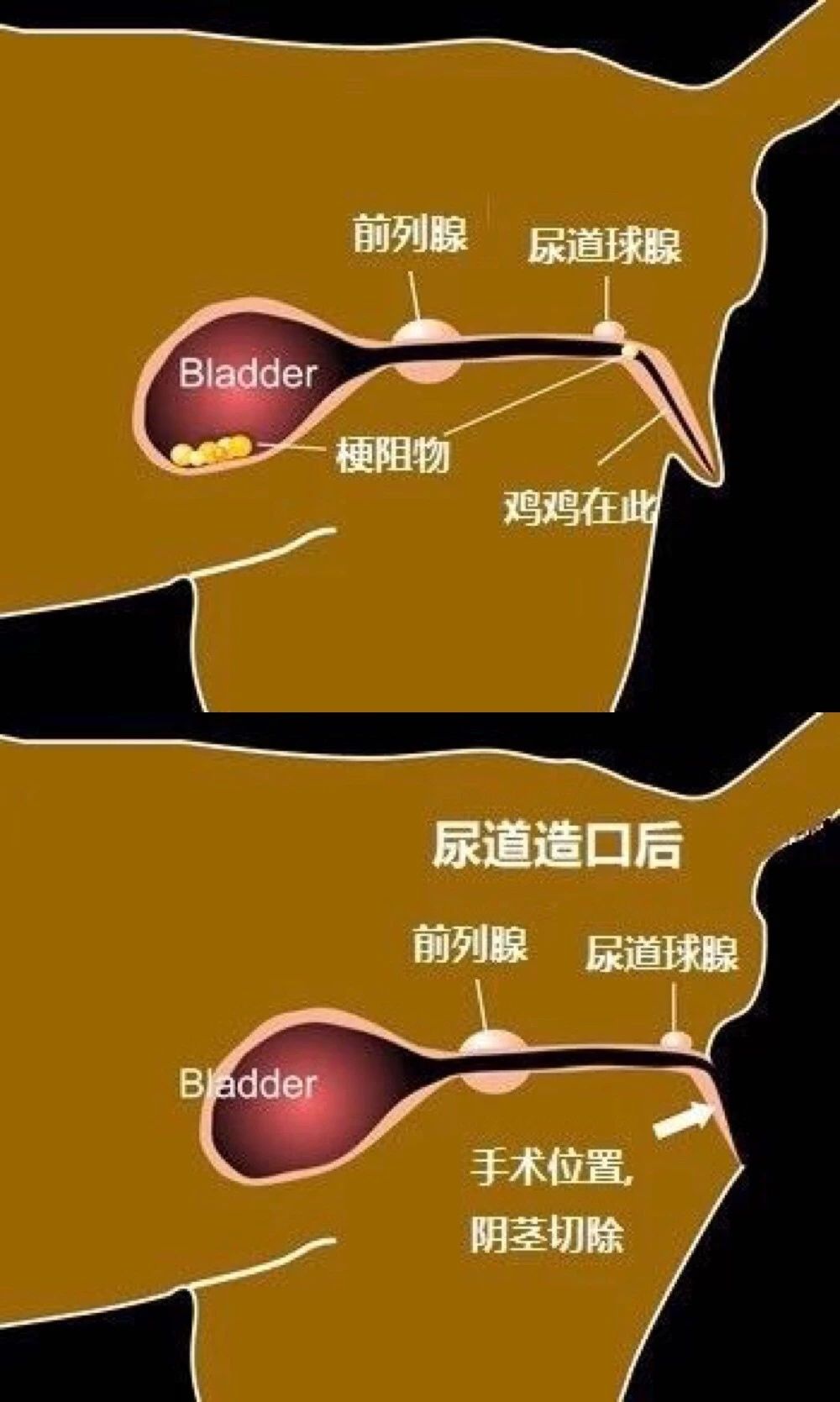 猫咪尿不出来可以吃什么药,猫咪尿不出来了要吃阿莫西林吗