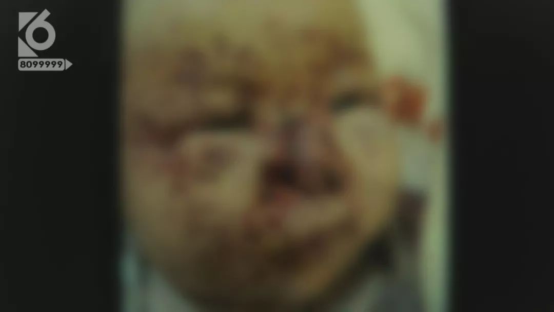 三个月女婴被老鼠啃,楚雄3月大女婴惨遭群鼠啃食脸部