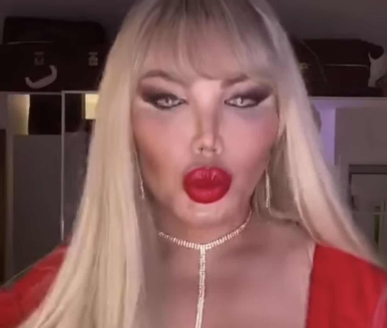 巴西男整容42次图片,巴西男模花数百万整容