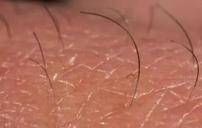 孩子背上长出“怪毛”,妈妈直接薅断,不料把娃薅进了ICU