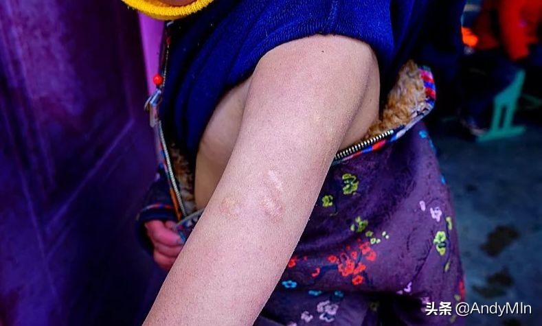 挖10万元1斤的虫草,却买不起一个玩具|高原孩子的残酷童年