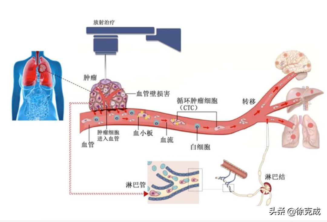 癌症的治疗与预防讲座的心得体会,癌症治疗的最终走向