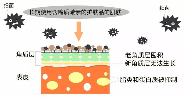 怎么样才能使角质层变薄,手部角质层变薄灼伤角质层