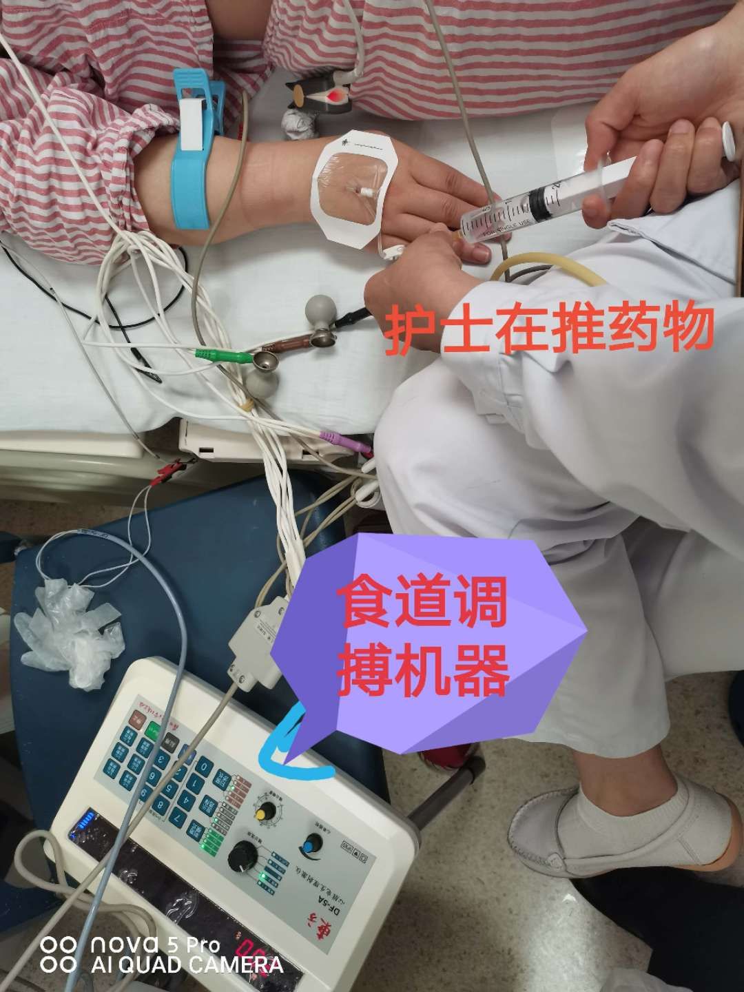 孕妇心动过速外加有点心肌缺血,怀孕心电图窦性心动过速心慌胸闷