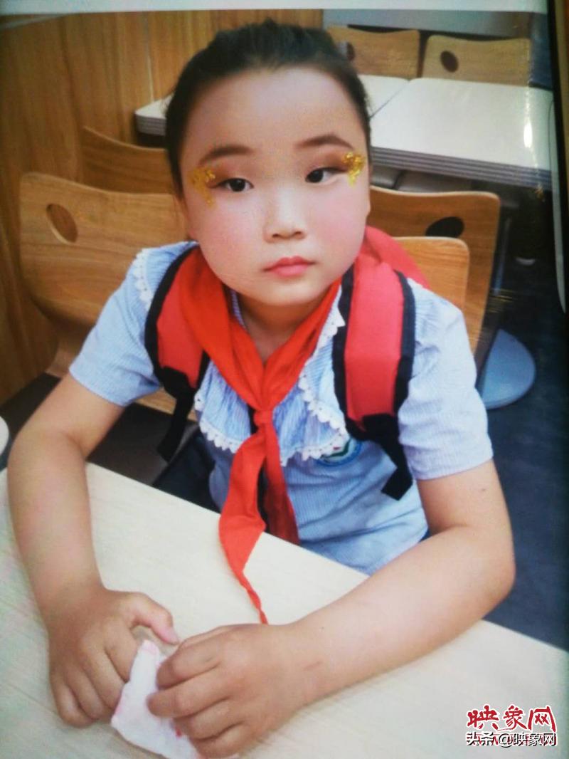 儿童急性脑脊髓炎能彻底治好吗,救救女童