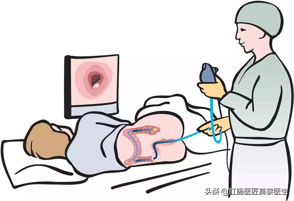 无痛肠镜息肉切除后几天恢复正常,无痛肠镜发现息肉会不会当场割掉