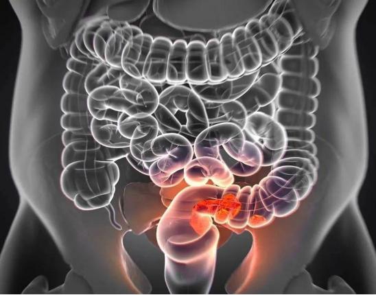 大便太硬出血肛裂会自愈吗,男子肛裂出血