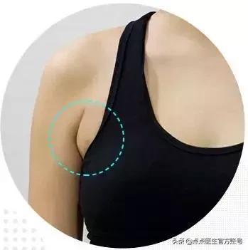 副乳怎么消除腋下赘肉,腋下凸起的肉肉是赘肉还是副乳